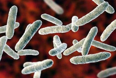 Shigellosis outbreak raises concerns in the US