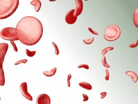 Visual Representation for sickle cells | Credits: Getty Images